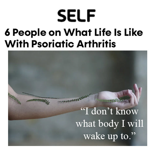 Self.com | 6 People on What Life Is Like With Psoriatic Arthritis
